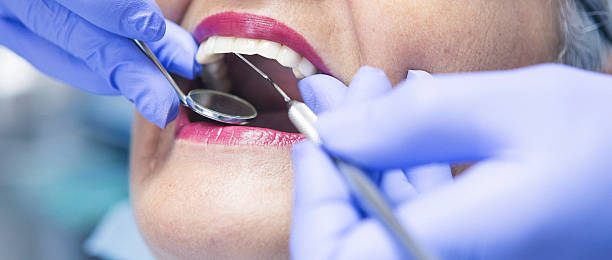 Best Emergency Root Canal Treatment in Greensboro, MD